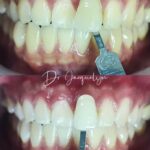 dr-jacquelyn-case-3