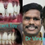 dr-vincent-case-1.jpg