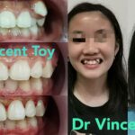 dr-vincent-case-3.jpg