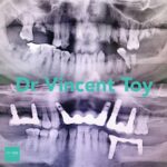 dr-vincent-case-7.jpg