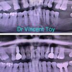 Dr-Vincent-Toy-Testi2